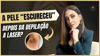 A pele do meu paciente escureceu pós depilação a laser e agora [upl. by Galatea676]