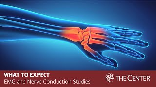 What to Expect During Nerve Conduction Studies and EMG Tests [upl. by Elaynad794]