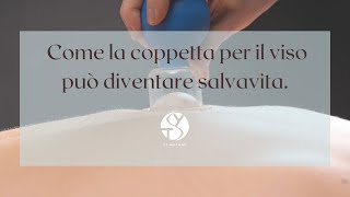 Come la coppetta per il viso può diventare salvavita [upl. by Anayad]