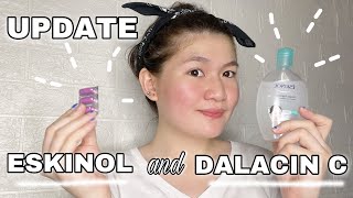 Inexpensive Acne Solution – ESKINOL and DALACIN C UPDATE  EY BELZY [upl. by Rahm778]