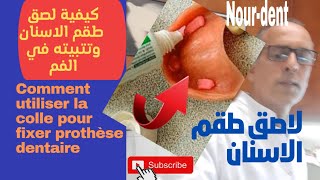 comment utiliser la colle pour fixer prothèse dentaire كيفية لصق طقم الاسنان و تثبيته في الفم [upl. by Eicam]