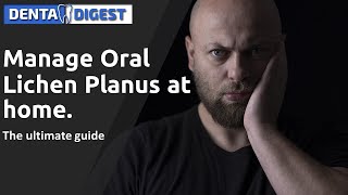 Manage Oral Lichen Planus at home The ultimate Guide [upl. by Nodnil]