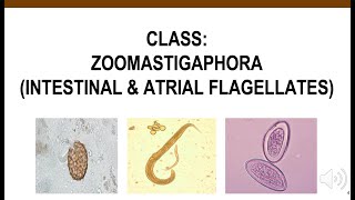 Intestinal amp Atrial Flagellates [upl. by Leinehtan]