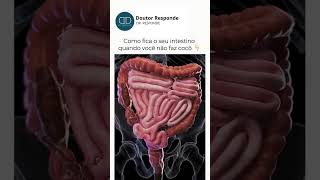 Constipação Intestinal [upl. by Naitsabas]