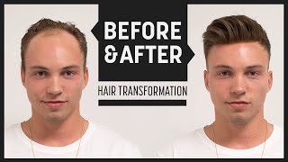 Johnny Edlind High Volume Hairstyle 2018  Transformation mit Haarsystem  Hairsystems Heydecke [upl. by Fabozzi293]