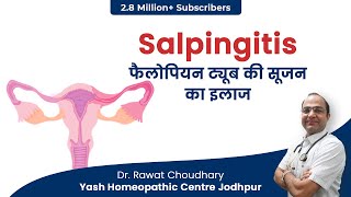 Salpingitis In Hindi  Salpingitis Treatment  Medicine for Salpingitis  Best Homeopathic Treatment [upl. by Frick]