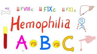 Hemophilia Types  hemophilia A Hemophilia B and Hemophilia C  Comparison  Genetics Hematology [upl. by Simmonds]