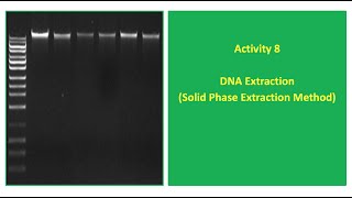 Activity 8 DNA Extraction Solid Phase Extraction Method [upl. by Bernarr]