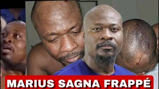 ⛑Urgence Les cicatrices visibles de lagression de Guy Marius Sagna au Togo [upl. by Haskel648]