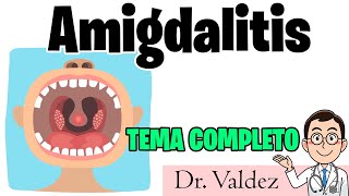 Garganta inflamada  AMIGDALITIS Causas Sintomas y Tratamiento [upl. by Holbrooke808]