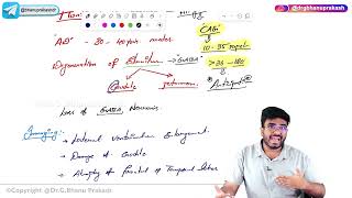 6 Huntingtons Disease Pathology 🧠 USMLE Step 1 [upl. by Rengia]