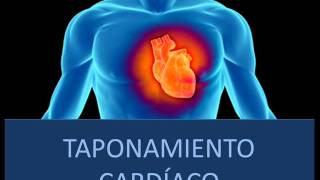 Taponamiento cardíaco  Fisiopatología [upl. by Attalanta]