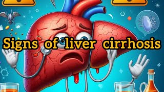 10 SIGNS OF LIVER CIRRHOSIS YOU SHOULDNT IGNORE [upl. by Damara162]