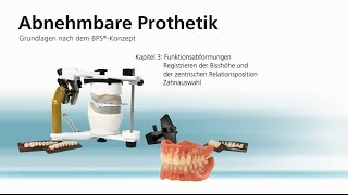 Abnehmbare Totalprothetik – Kapitel 3 [upl. by Halimak]