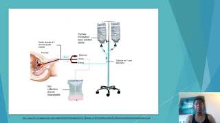 Labo 13 Irrigation vésicale [upl. by Ahseet894]
