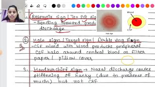 CSF rhinorrhea  causes symptoms Signs diagnosis treatment [upl. by Rehpotsirahc]