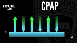 Short and Simple CPAP vs BiPAP [upl. by Beverley805]