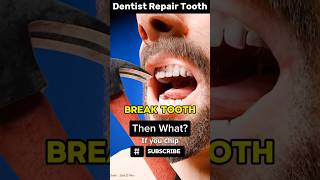 How to Repair Broken Tooth 🔥 दांत को कैसे बनाए  ✅ shorts teeth factssidd zackdfilms facts [upl. by Ardeahp]