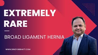 Broad ligament Hernia Repair  Extremely rare hernia  lap repair of only female type hernia [upl. by Gallenz]