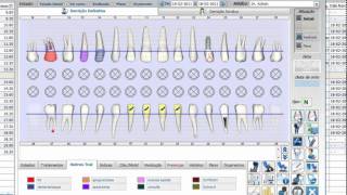 Odontograma  Newsoft DS 11 [upl. by Eno]