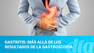 Gastritis más allá de los resultados de la gastroscopia [upl. by Filberto115]