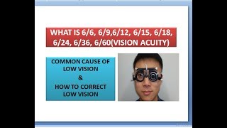 WHAT IS 66 69612 615 618 624 636 660 eye vision and ITS CAUSE AND SOLUTION [upl. by Ahsiemac]