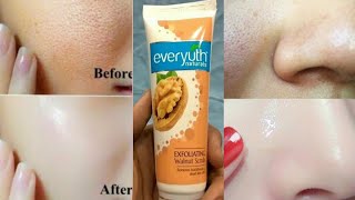 How to Use Face Scrubs  Everyuth ScrubHow to Apply Face Scrub at Home Hindi [upl. by Egni991]