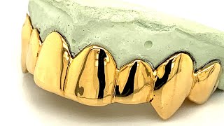 Can Grillz Work If I Have Crooked Teeth CHECK THIS OUT [upl. by Hummel371]