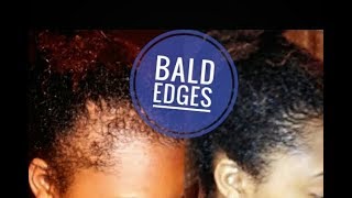 How I use GINGER AND CASTOR OIL TO REGROW MY BALD EDGES  GINGER HAIR MASK FOR EXTREME HAIR GROWTH [upl. by Ecyac]