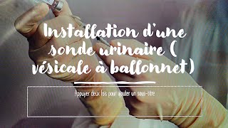 comment installer une sonde urinaire vésicale à ballonnet [upl. by Nil]