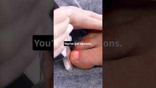 Absolute Best Toenail Fungus Cure [upl. by Legnaros]