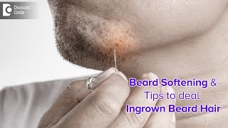 INGROWN BEARD HAIR  Ingrown facial hair in MEN Causes amp Treatment Dr Nischal K  Doctors Circle [upl. by Micheline]