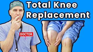 Life at Home After Total Knee Replacement Essential Recovery Guide [upl. by Aicel]