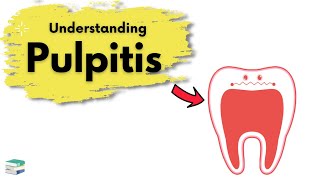 What is Pulpitis  Endodontics [upl. by Eded]