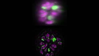 C elegans multiview deconvolution I [upl. by Yevette369]