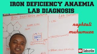 Iron Deficiency Anaemia  Causes amp Signs  Lab diagnosis  Hematology [upl. by Ilram145]