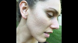 Why I Wash My Face With Dr Bronners Castile Soap Acne Prone Skin PH Acid Oil etc [upl. by Ermine]