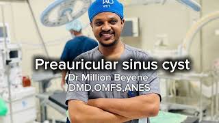 preauricular sinus cystበጆሮ በዚጋ እንደዚአይነት ምልክትና ፈሳሽ አላችሁ መታከም ይችላል [upl. by Nnaylloh498]