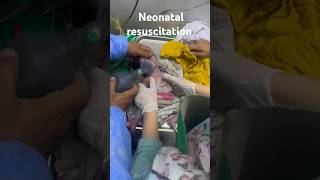 Neonatal Resuscitation Respiratory distressed newborn management CPR child [upl. by Arihay]