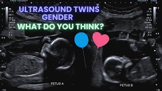 Ultrasound Pregnancy Twins Gender Identification Special interaction between the twins ❤️ [upl. by Acinorev]