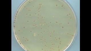 Preparation of Competent Cells Using Calcium Chloride  Amrita University [upl. by Zohara]