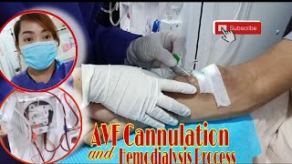 HEMODIALYSIS PROCESS AND AVF CANNULATION  Dialysis Nurse [upl. by Pros400]