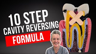 The 10Step Dental Cavity Reversing Formula Holistic Dentist Brisbane [upl. by Oilejor]