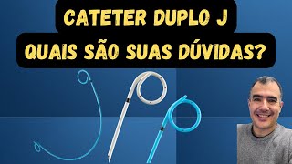 Cateter duplo J Quais são as suas dúvidas [upl. by Raama]