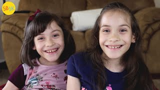 Conjoined Twins Who Were Separated A Miraculous Story [upl. by Kenwrick]