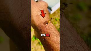 How To Survive a Bee Sting 😨 [upl. by Nulubez974]