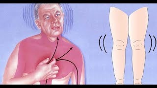 Ces 6 symptômes vous avertissent que vous pouvez avoir une crise cardiaque le mois prochain [upl. by Collayer967]