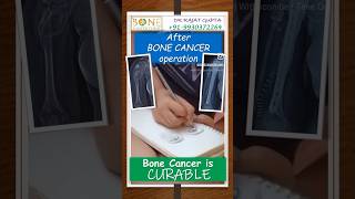 Bone Cancer Osteosarcoma patient drawing portrait after operation Dr Rajat Gupta bonecancerclinic [upl. by Guadalupe]