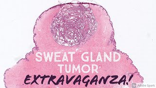 Sweat Gland Tumor Dermatopathology Board Review 31 Slides  Pathology Dermpath Dermatology [upl. by Rozella]