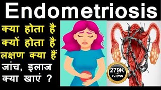 What is Endometriosis in Hindi Symptoms Treatment Diet Surgery Occurs Affects fertility [upl. by Gustav204]